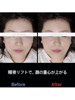 美容矯正サロン レレポノ(LELEPONO)/