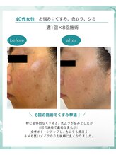 サロン アンネ(Anne)/