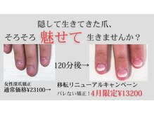 ヴェールリム(verl lim)