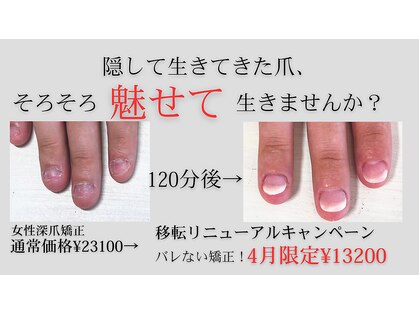 ヴェールリム(verl lim)の写真