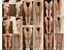 パリスヒロトン(PARIS HIROTON)の雰囲気（定額制だから、お金気にせず施術に集中出来る。）