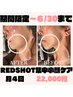 月4回集中!二十顎、頬肉アプローチ脂肪分解剤導入小顔になりたい方¥56,000→