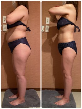 プレナスローズハート(PLENUS ROSE HEART)/効果抜群！スッキリBODYへ！