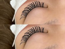 アンダーバーホワイト 大阪上本町店(_WHITE)/バインドロックフル160本