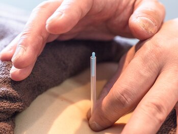 さいわい整骨院/鍼・灸施術もあります