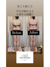 アジャストメント ナチュラル(adjustment natural)/Before&After