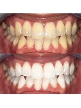 ライトビューティー 池袋店(LightBeauty)/症例写真