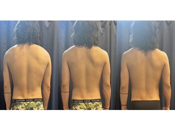 月香館/【コリ疲労回復】筋膜リリース