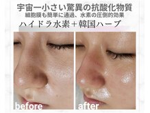 キレイラボ(Ki-Re-i LABO)の雰囲気（殿堂入りＮｏ.１★ご詳細はフォトをご覧ください♪）