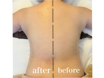 リコット(Licott)/before after写真