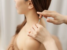 小顔美容鍼&鍼灸salon N【鍼灸×小顔×美容鍼×肌質改善herb peeling】