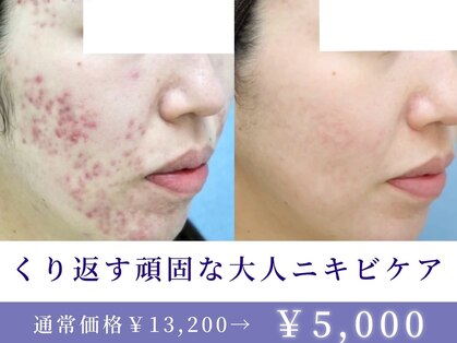エピア 岡崎店(Epia)の写真