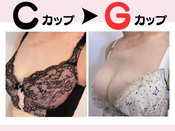 リリ(RILI)/【バストアップ・バストケア】