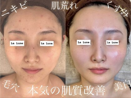 ラリュンヌ(La Lune)の写真