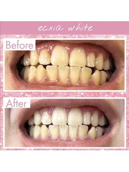 エクシアホワイト 長野店/