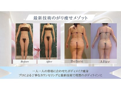 メルローズ 麻布十番店(Melrose)の写真