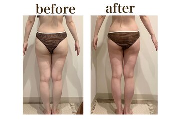 ルアバイアロ(Lua by Alo's)/脚の凹凸ケア