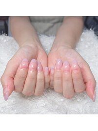 フレンチ☆フィルイン☆ケア