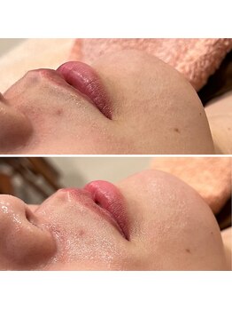 ハル(haru)/FWTフェイスワックス