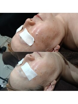 ボーソリューション(Beau-Solution)/【50代　エイジングケア】