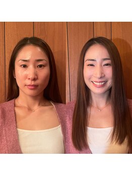 パーソナルサンフラワー(PersonalSunflower)/お客様ヘアメイクBefore/After