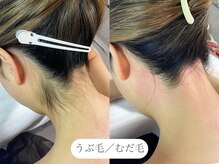 フラックス 京都(FLUX)/【ワックス脱毛】うなじ