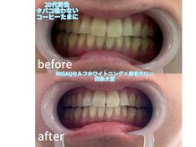 ミガク 京都四条大宮店(MIGAQ)の雰囲気（歯科医師監修、しみない、食事制限なし♪一回でも効果あり！）