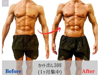 マリス(MARISS)/メンズ・カット出し施術<痩身>