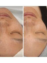 ココ(COCO)/放置してません？シミくすみ対策