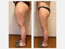 練馬アカデミア美容整体院の雰囲気（美容整体/骨盤矯正/小顔/姿勢/XO脚/マタニティ/産後/ダイエット）