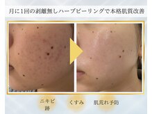 エレナ(ELENA)の雰囲気（【お悩みに合わせて】あなただけのオーダーメイド施術）