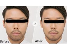 ルナ(Luna)/デザインひげ