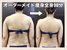 スワン 新栄店(SWAN)/オーダーメイド痩身全身90分B→A