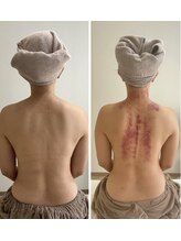 リュクス(Luxe)/初回ビフォーアフター（40代）