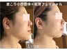 【リピーター様用】肌育フェイシャル×首こり小顔整体 　¥27,000→¥17,000