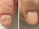 ネイルズシアムの写真/見せるのが恥ずかしかったボロボロの指先が、120分後には見られても恥ずかしくない指先に！