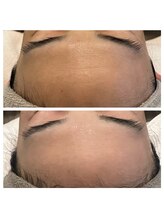 美温(mion)/艶＆キメが整う