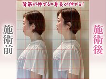 筋膜整体 ヒデ 福岡博多(HIDE)