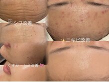 エクラ(eclat)の雰囲気（痩身・肌質改善どちらも、2回目以降も通いやすい価格設定◎）