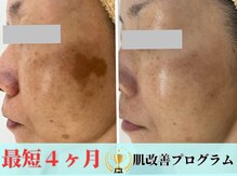 アップル 宮原店(Apple.)