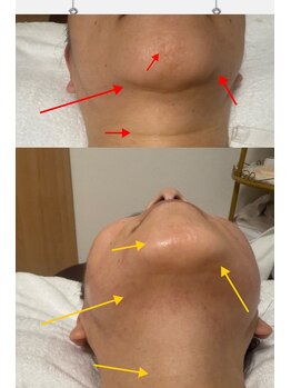 ミナミ/【-5才若見え即効小顔】