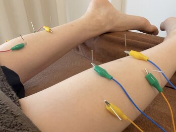 鍼灸 整体院 スズユ(SUZUYU)/【北浜/鍼灸/整体/むくみ改善】