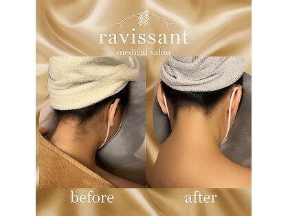 ラヴィソン(ravissant)の写真