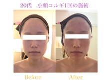 ビューティーサロン ヴェール(Veil)/本格小顔コルギ♪