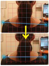 ふくろう整骨院/一度で変わるふくろう式施術