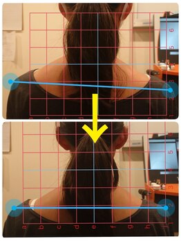 ふくろう整骨院/一度で変わるふくろう式施術