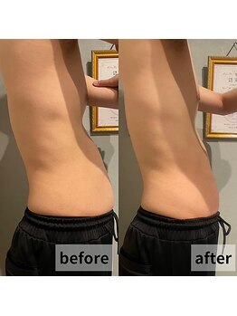 セイリキ(SEIRIKI)/★痩身ダイエットお客様のお声★