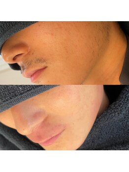 シープラス(C+)/