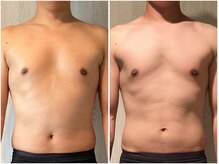 インプルーブ 浜北店(Improve)/体脂肪率-8.8％！　30代男性