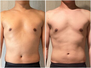 インプルーブ 浜北店(Improve)/体脂肪率-8.8％！　30代男性